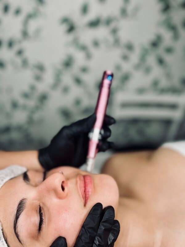 Revita Pen