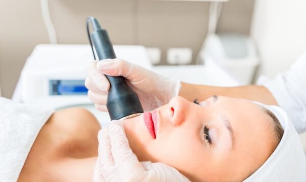 Radiofrecuencia Facial